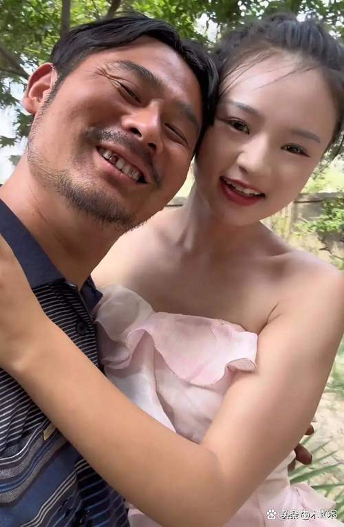 激光祛斑一般去哪里好点 激光祛斑一般去哪里好点