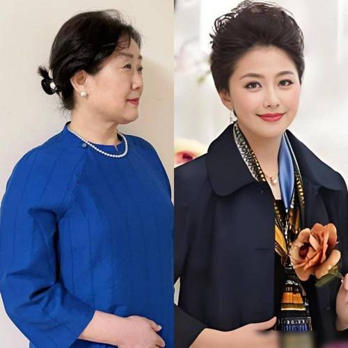 中药祛斑是不是色素提取 中药祛斑是不是色素提取