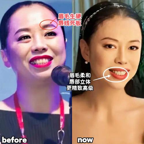 不用激光祛斑的女明星 不用激光祛斑的女明星