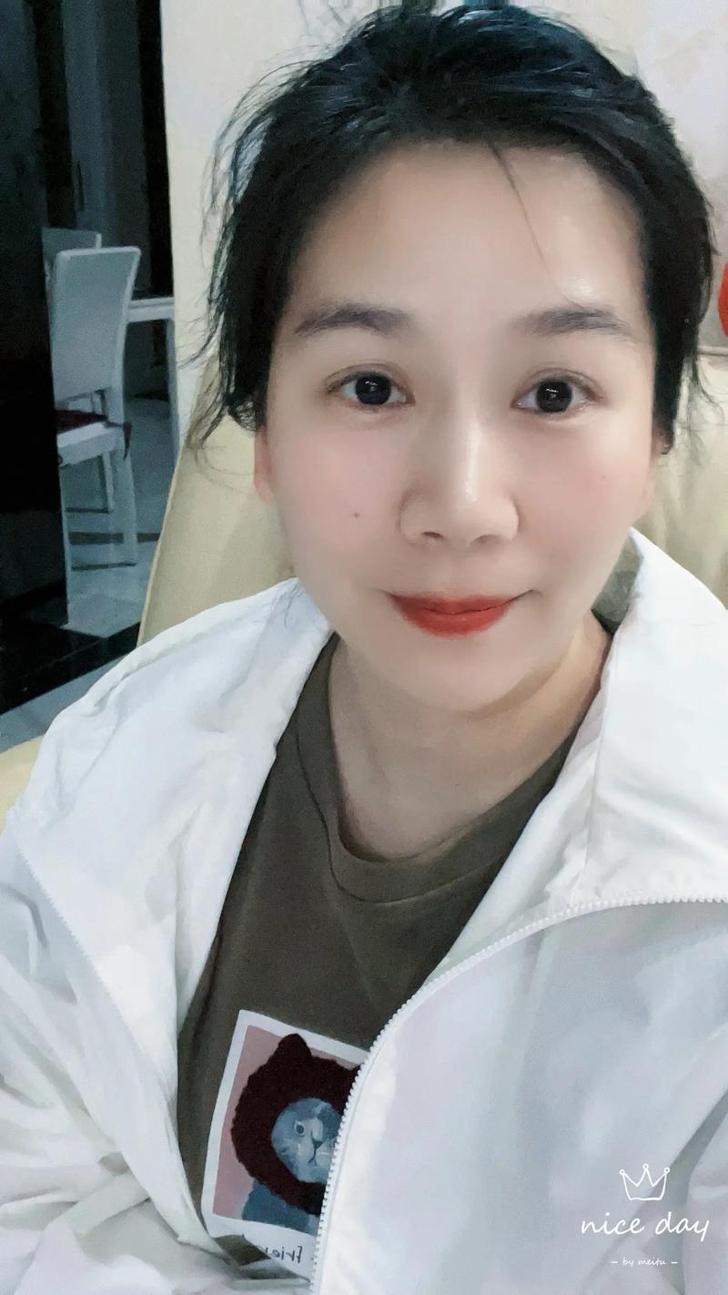 汕头有名的激光祛斑医生 汕头有名的激光祛斑医生