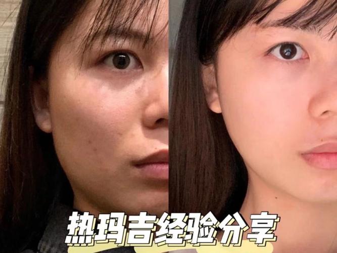 民间祛斑美白法有用吗 民间祛斑美白法有用吗