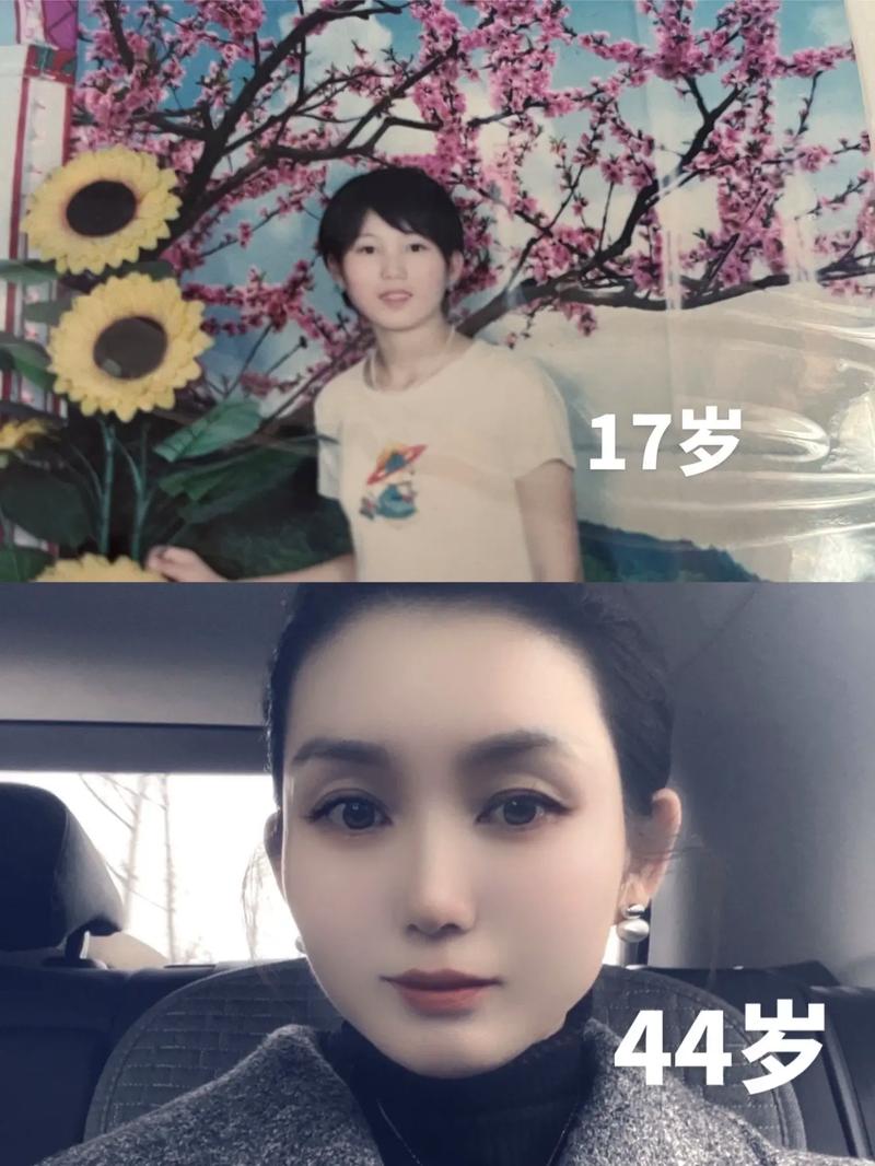 祛斑淡斑女_祛斑 淡斑 祛斑淡斑女_祛斑 淡斑