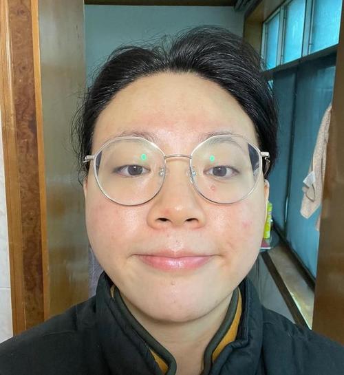 茶树精油祛斑吗 茶树精油祛斑使用方法