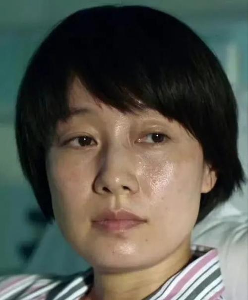 美容祛斑会 美容院祛斑会有后遗症吗 