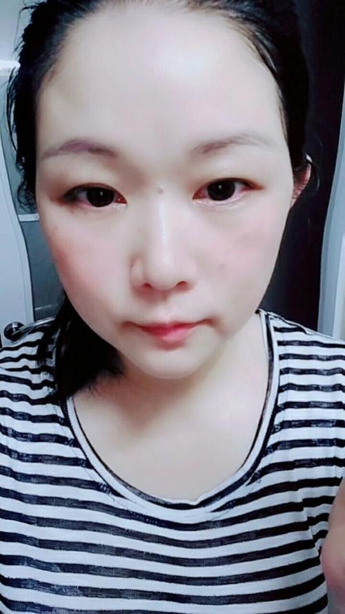 祛斑面膜要涂多久最好