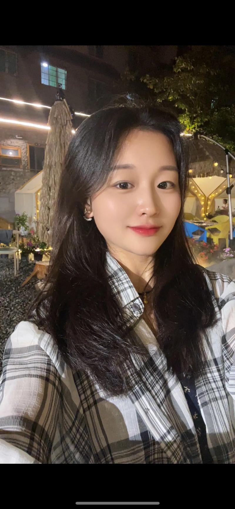 深圳哪里做激光祛斑好