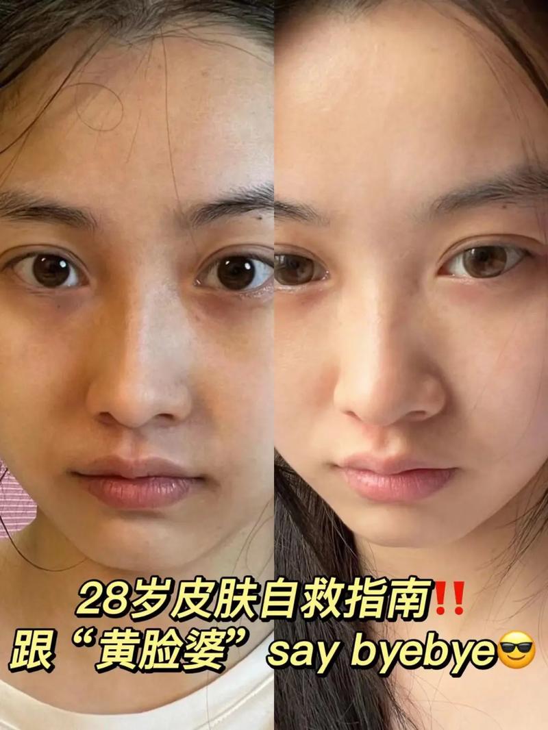 祛斑洗斑粉 祛斑粉有用吗 祛斑洗斑粉 祛斑粉有用吗
