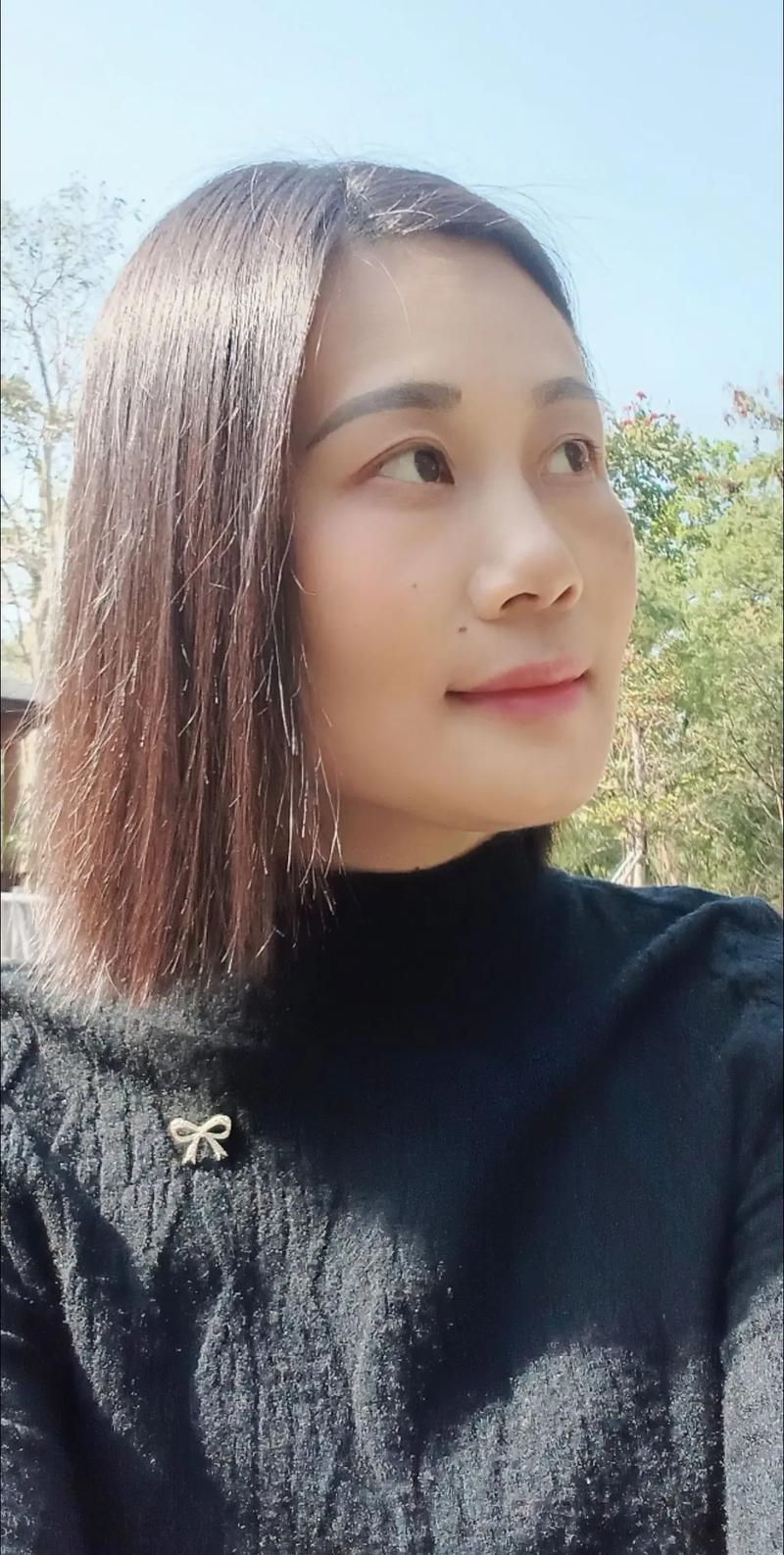 红霉素软膏能祛斑美白嘛 红霉素软膏能祛斑美白嘛