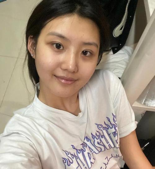什么牌子祛斑最好效果最佳 什么牌子祛斑最好效果最佳