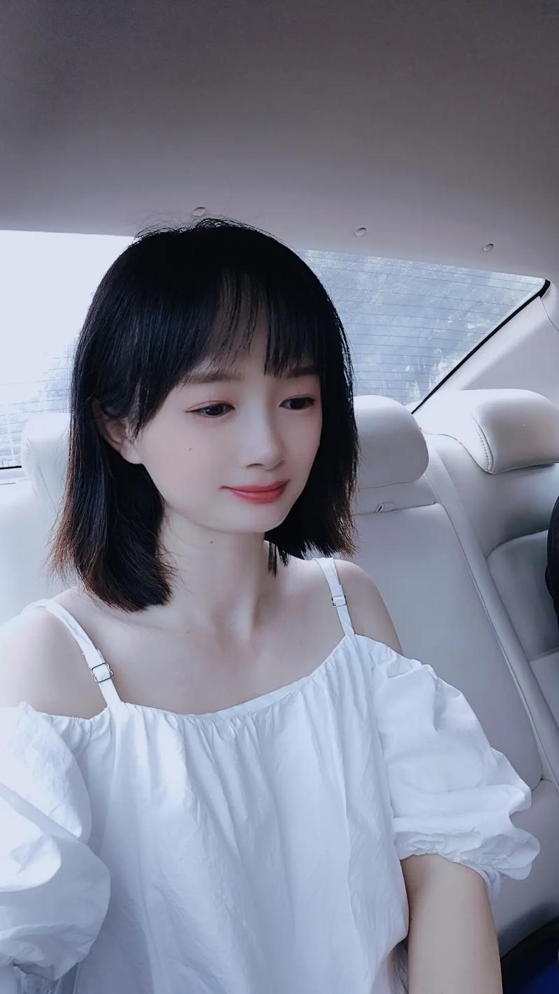 做完激光祛斑要注意什么 做完激光祛斑要注意什么