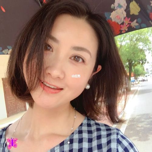 激光祛斑利弊 激光祛斑利弊是什么 激光祛斑利弊 激光祛斑利弊是什么