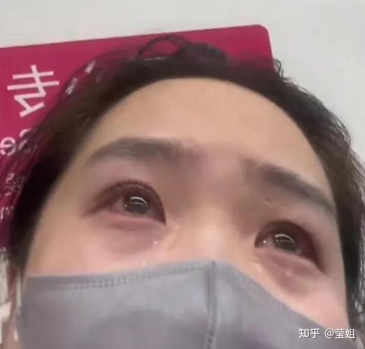 调q激光祛斑仪器有哪些