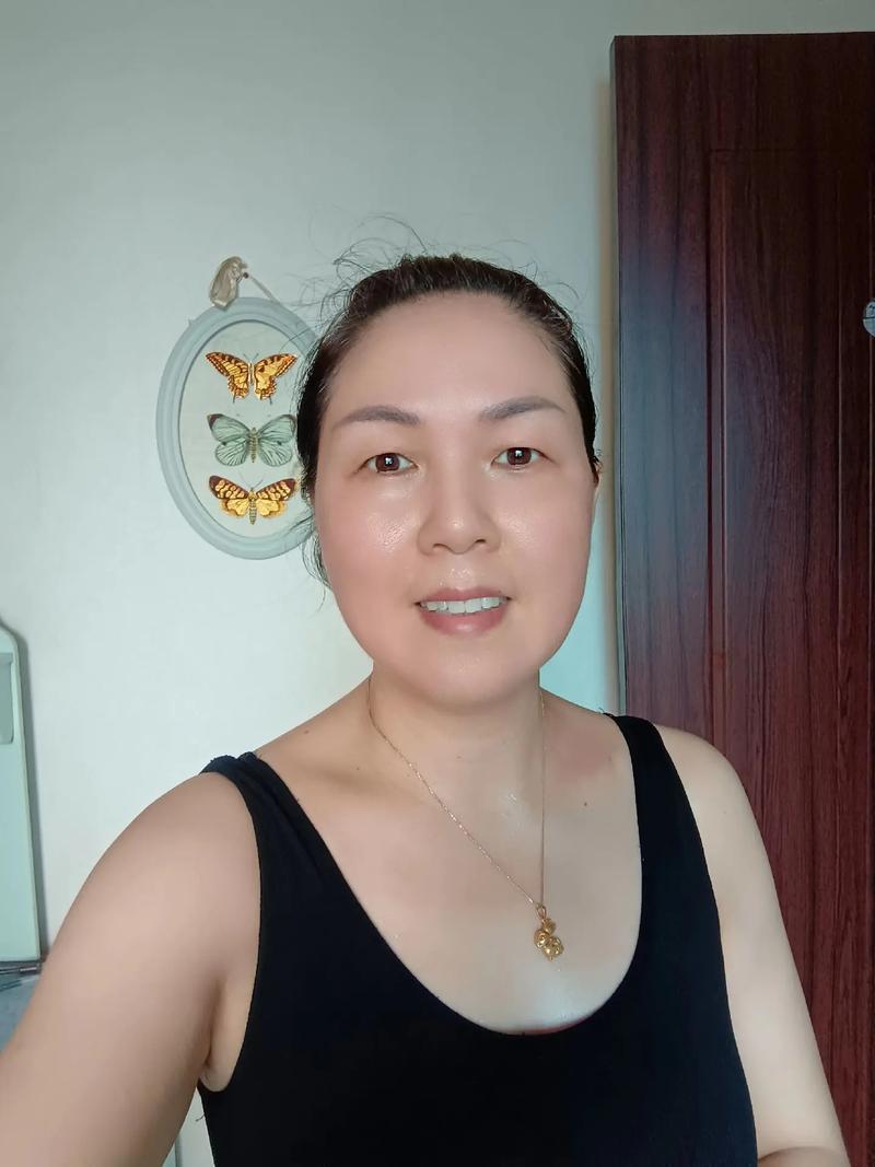 遗传斑祛斑后会复发吗 遗传斑祛斑后会复发吗