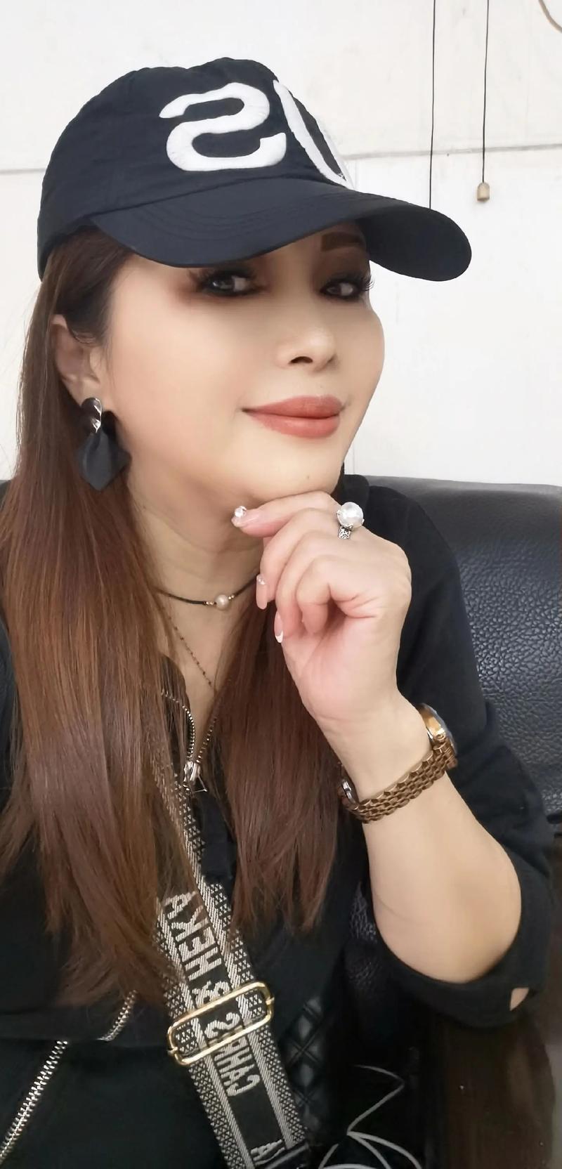 激光祛斑后要注意什么事项呢