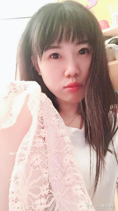 的祛斑技术有效吗 的祛斑技术有效吗