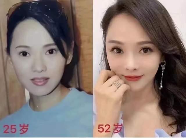 西安临潼祛斑哪里好啊