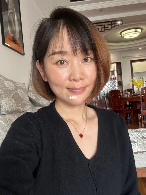 杭州哪里可以激光祛斑