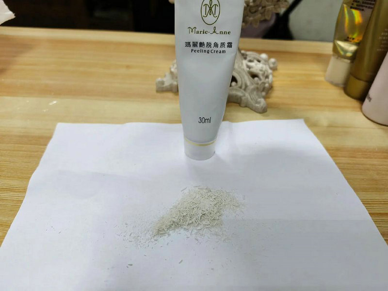 金华光子祛斑和激光祛斑