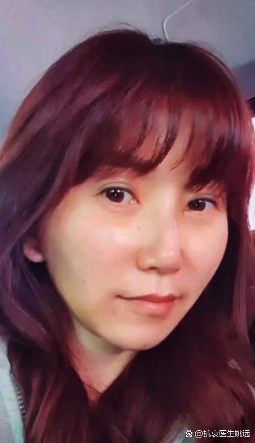 韭菜洗脸祛斑_韭菜洗脸的功效与作用 韭菜洗脸祛斑_韭菜洗脸的功效与作用