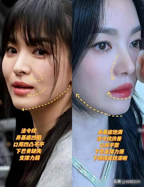 祛斑用什么套装好什么祛斑套装效果好 祛斑用什么套装好什么祛斑套装效果好