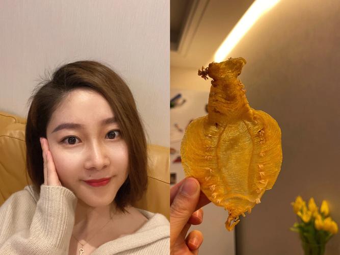 激光祛斑后可吃葡萄吗 激光祛斑后可吃葡萄吗