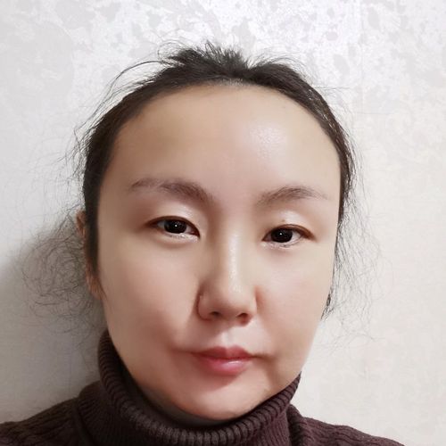 斑小朵祛斑怎么样_斑小白祛斑效果怎么样 斑小朵祛斑怎么样_斑小白祛斑效果怎么样