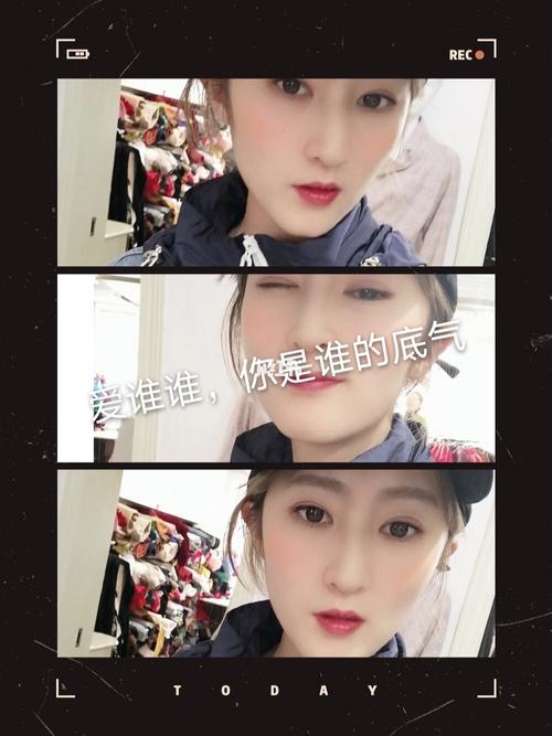 张芝山激光祛斑多少钱