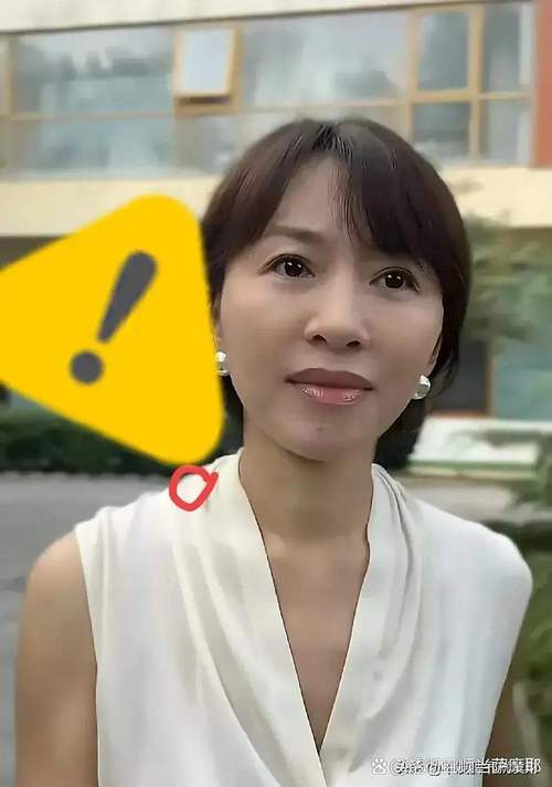 祛斑后一定要控色吗 祛斑后必须控色吗 祛斑后一定要控色吗 祛斑后必须控色吗