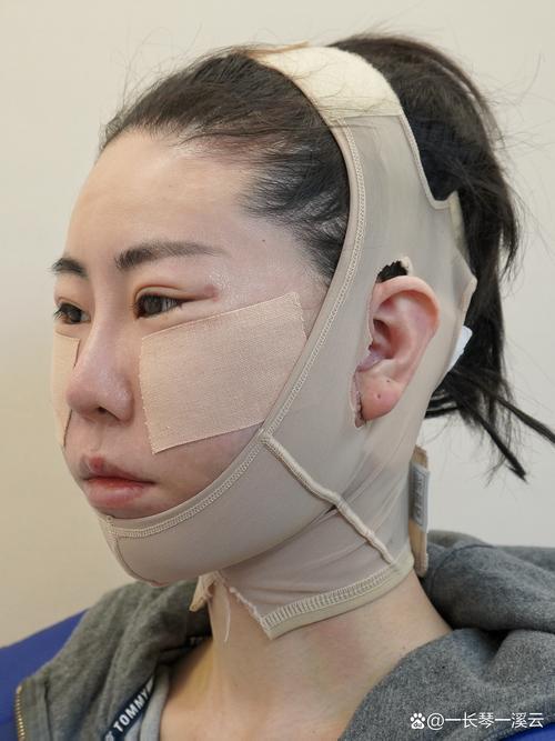 射洪美容祛斑 射洪整形美容院哪家好 射洪美容祛斑 射洪整形美容院哪家好