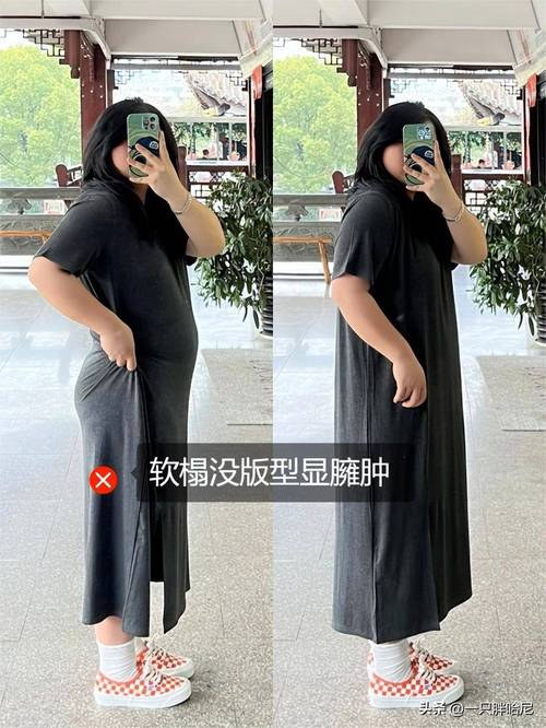 去医院皮肤科祛斑可以吗 去医院皮肤科祛斑可以吗