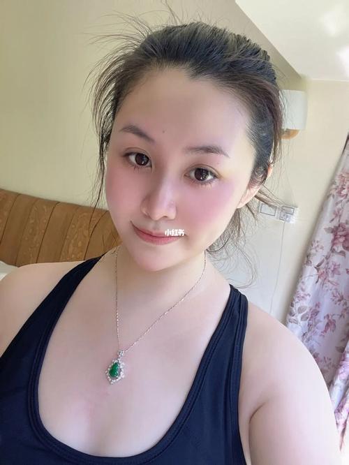 激光祛斑多久能吸烟啊