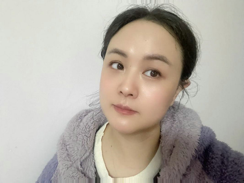 美容院祛斑做什么好点