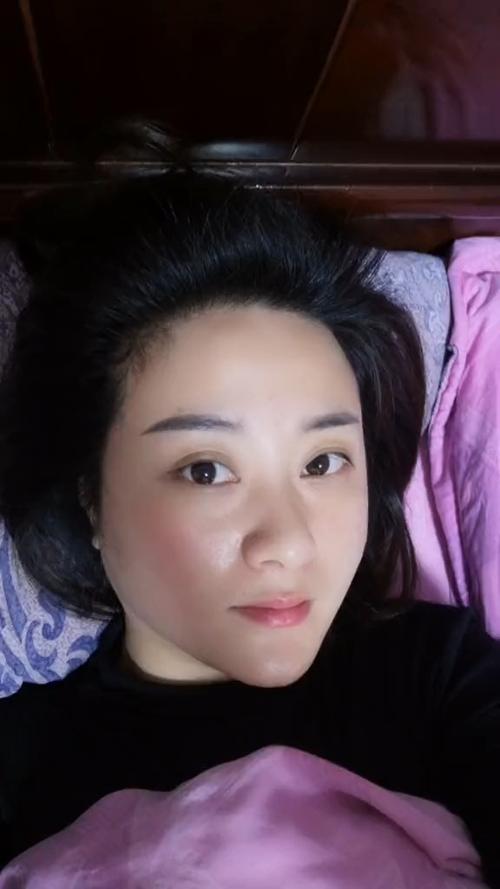 任县美容祛斑_任县美容祛斑哪家好 任县美容祛斑_任县美容祛斑哪家好