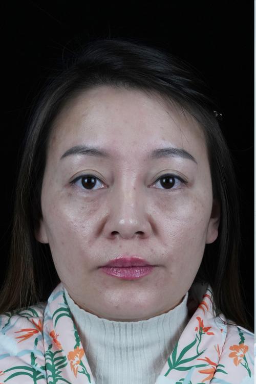 自动启停功能是开着好还是关着好(自动启停功能是开着好还是关闭好) 自动启停功能是开着好还是关着好(自动启停功能是开着好还是关闭好)