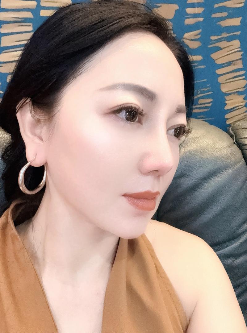 昌乐祛痘祛斑祛痣 昌乐哪家诊所治皮肤病好 昌乐祛痘祛斑祛痣 昌乐哪家诊所治皮肤病好